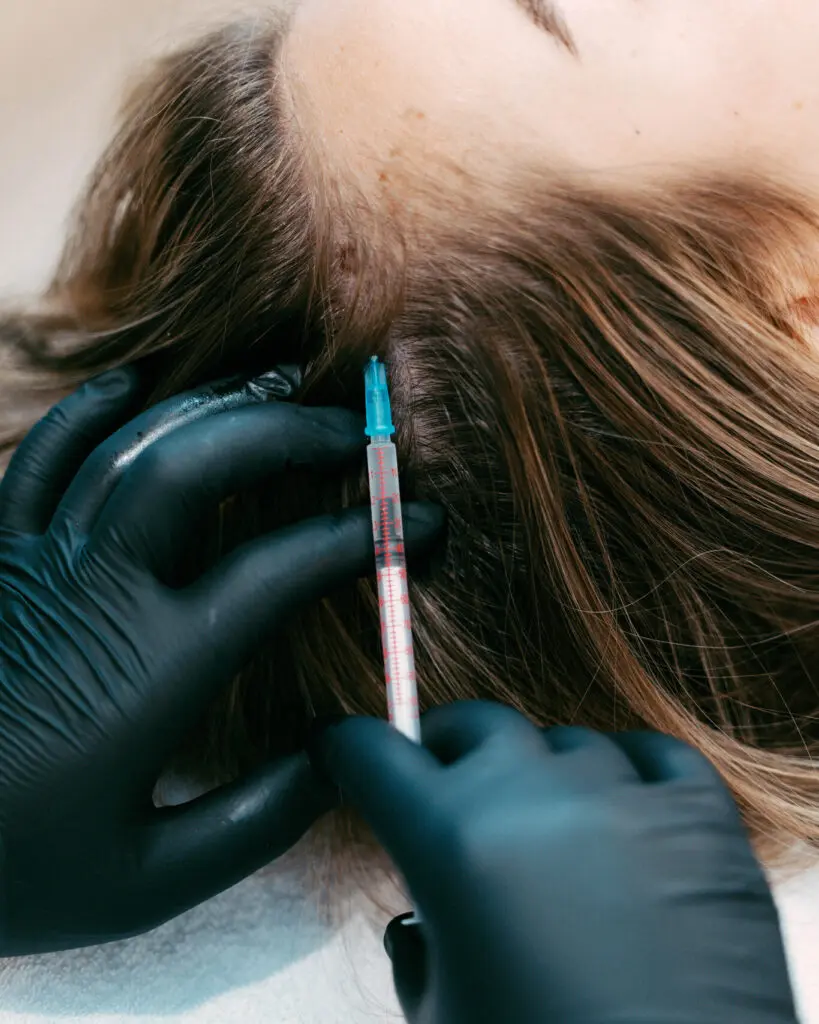 Mezoterapi për flokët në Eden Laser Clinic